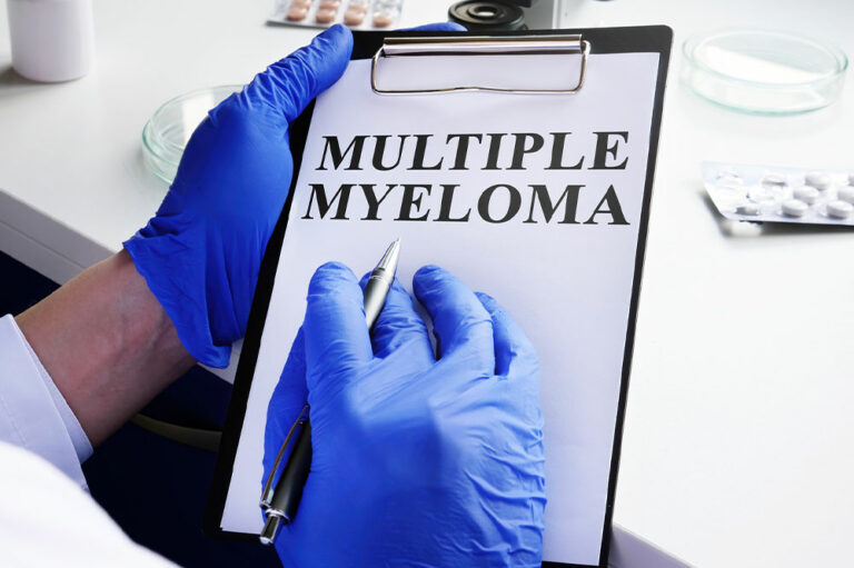 Multiple Myeloma &#8211; Symptoms, and Management Tips