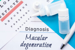 Key facts about age-related macular degeneration