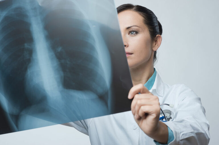 15 signs of MAC lung disease one shouldn&#8217;t ignore