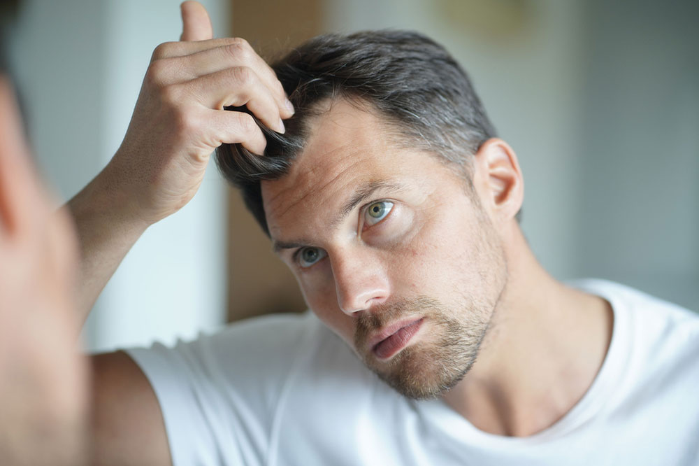 9 Medical Conditions That May Trigger Severe Hair Loss